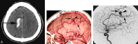 Fig 2.