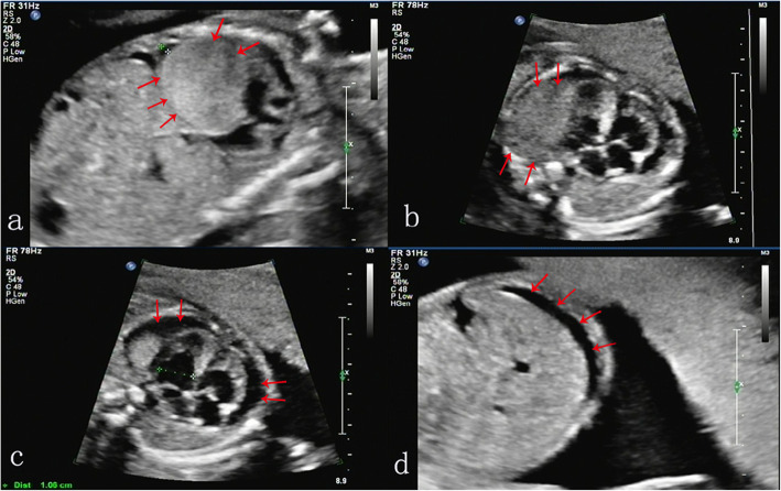 Fig. 3