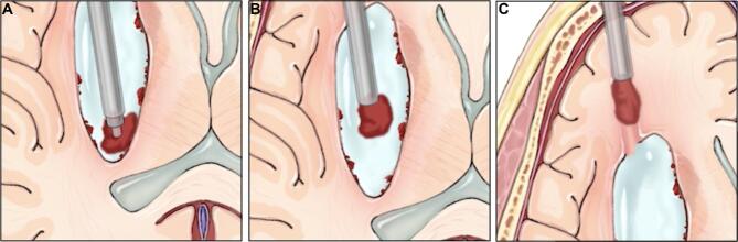 FIGURE 4.