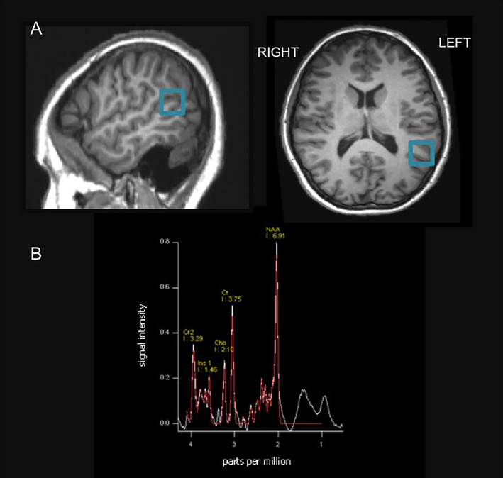 Figure1.