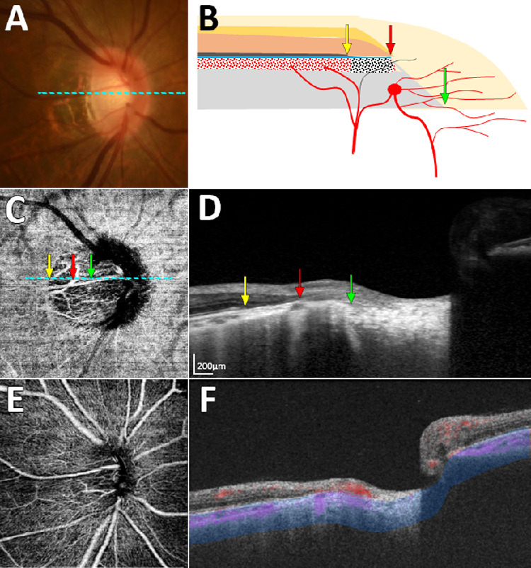 Figure 3.