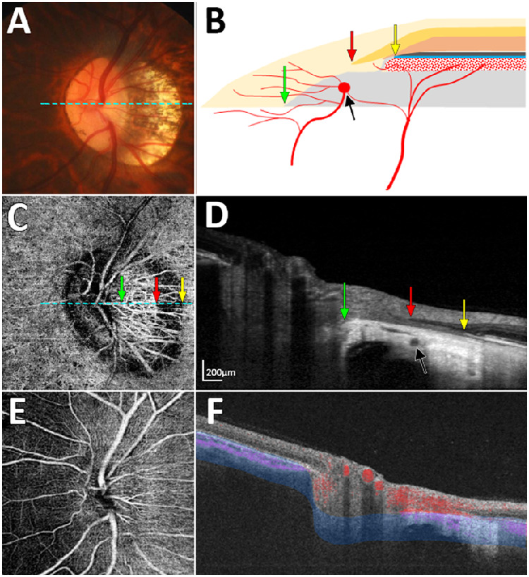 Figure 2.