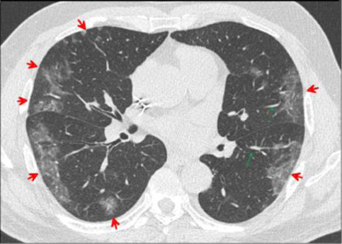 Fig. 19