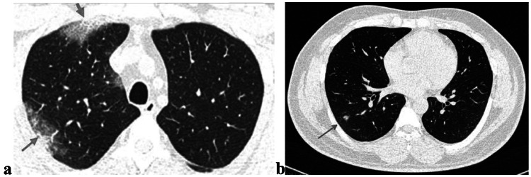 Fig. 13