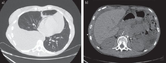 FIGURE 3