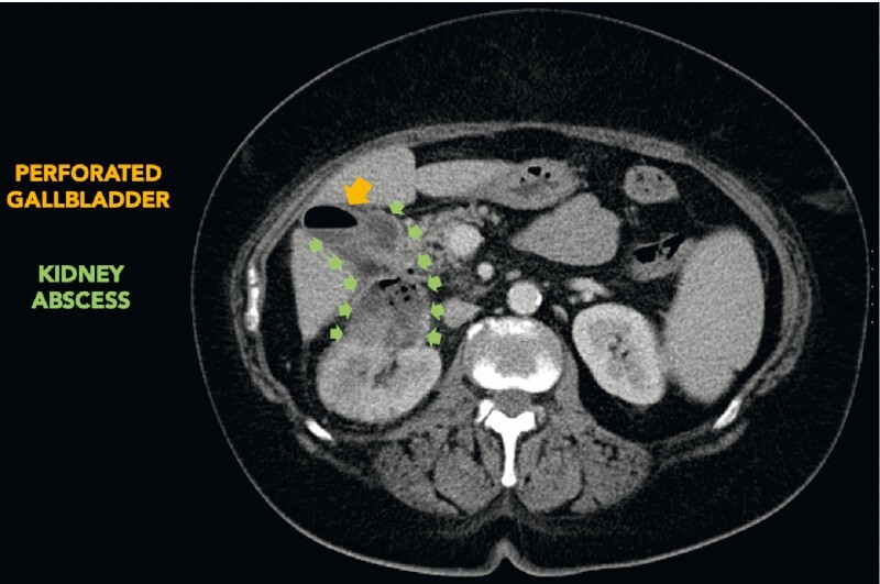 Fig. 1