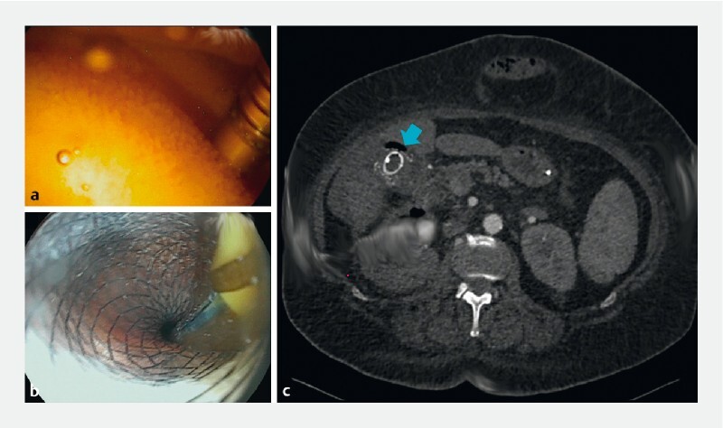 Fig. 2