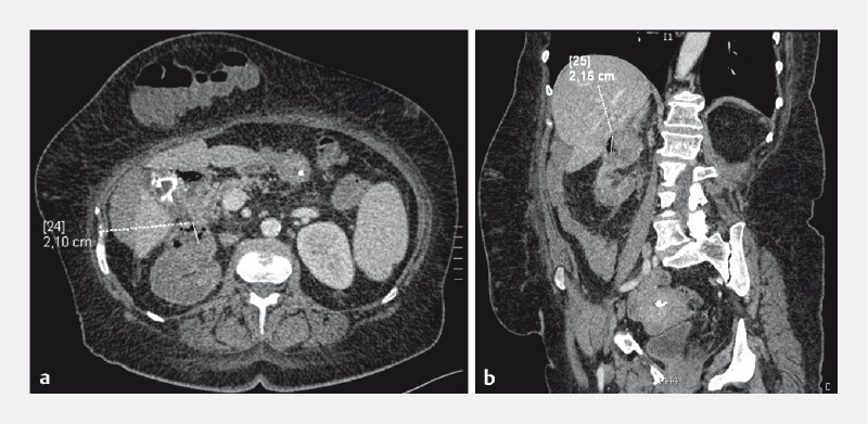 Fig. 3