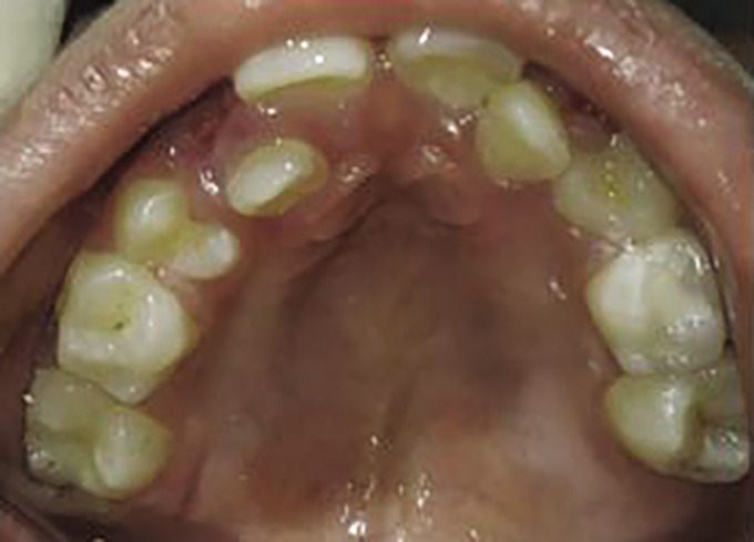 Fig. 9