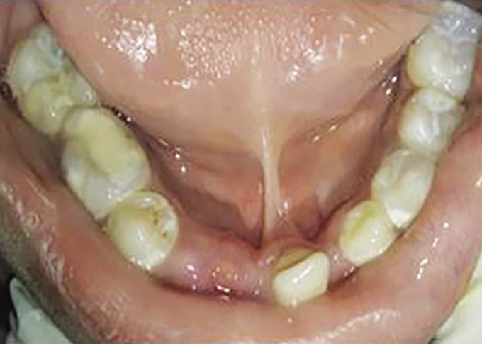 Fig. 10