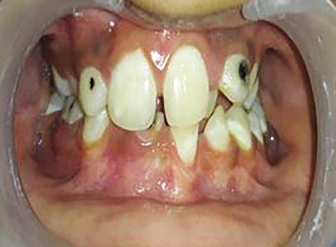 Fig. 5