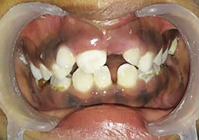 Fig. 15