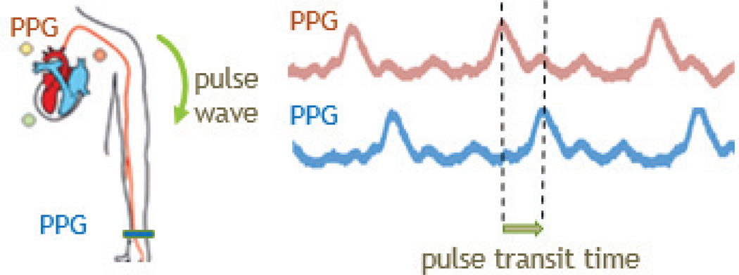 Fig. 14