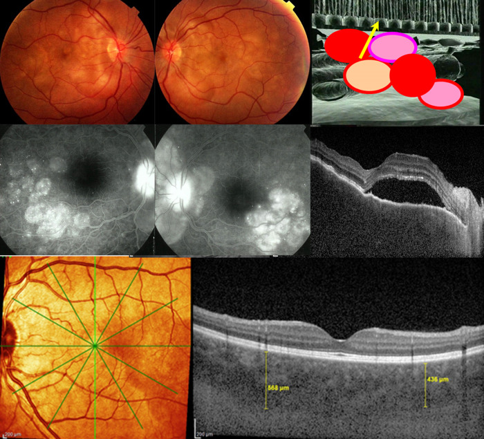 Fig. 2