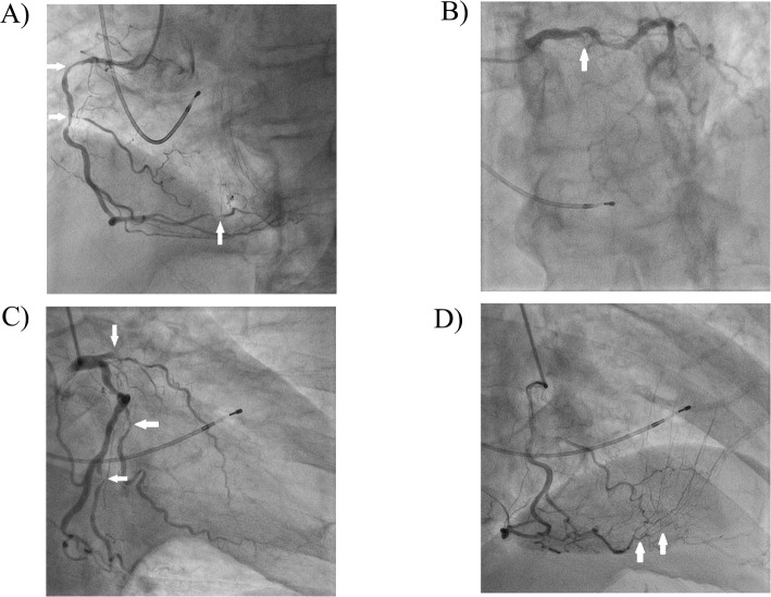 Fig. 2