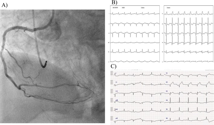 Fig. 4