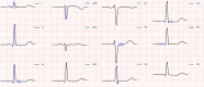 Figure 5