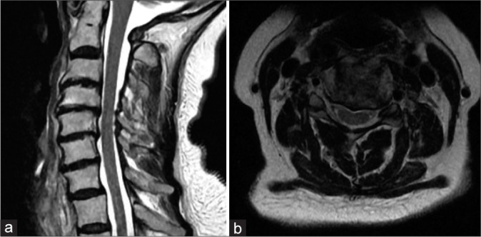 Figure 2: