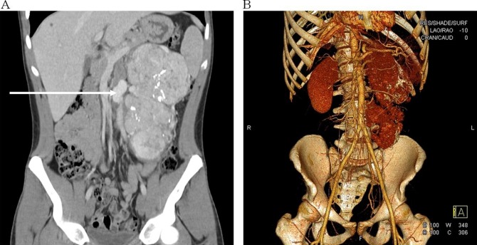 Figure 1