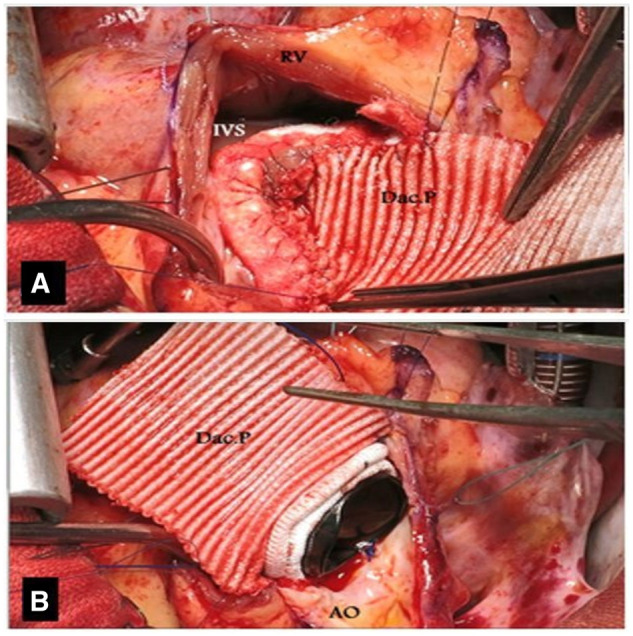 Figure 2: