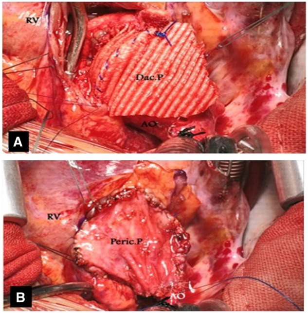 Figure 3: