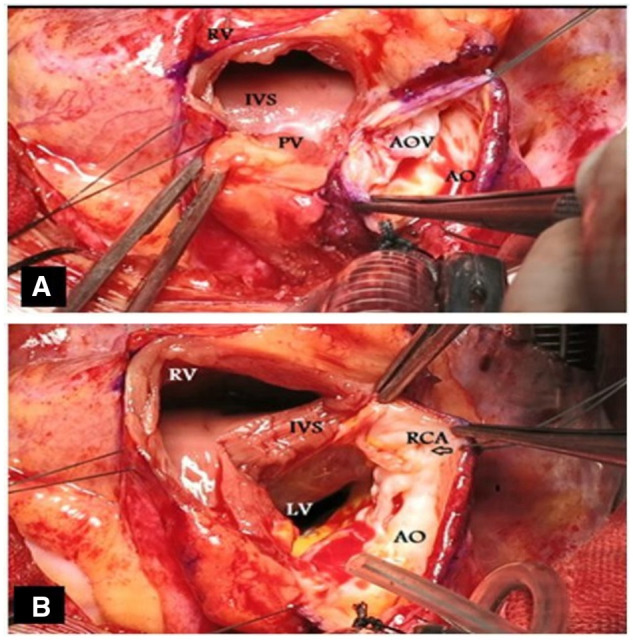 Figure 1: