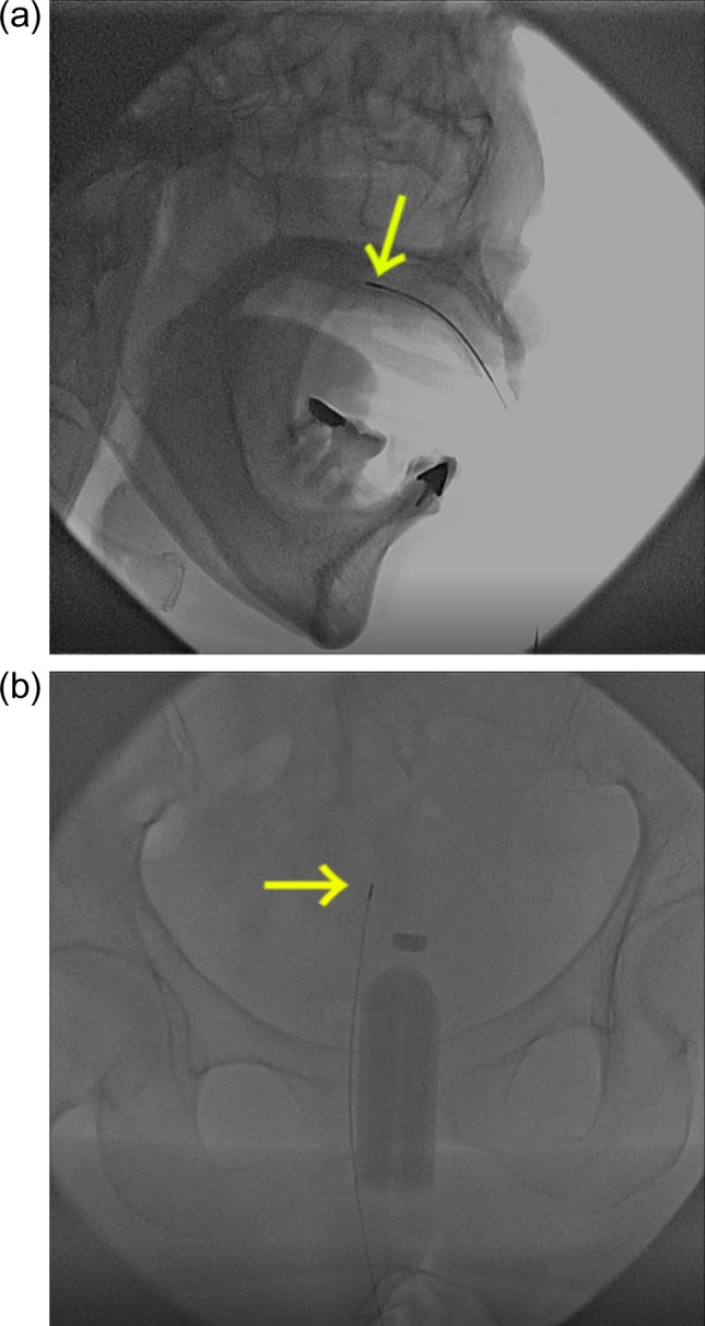 Fig. 4.