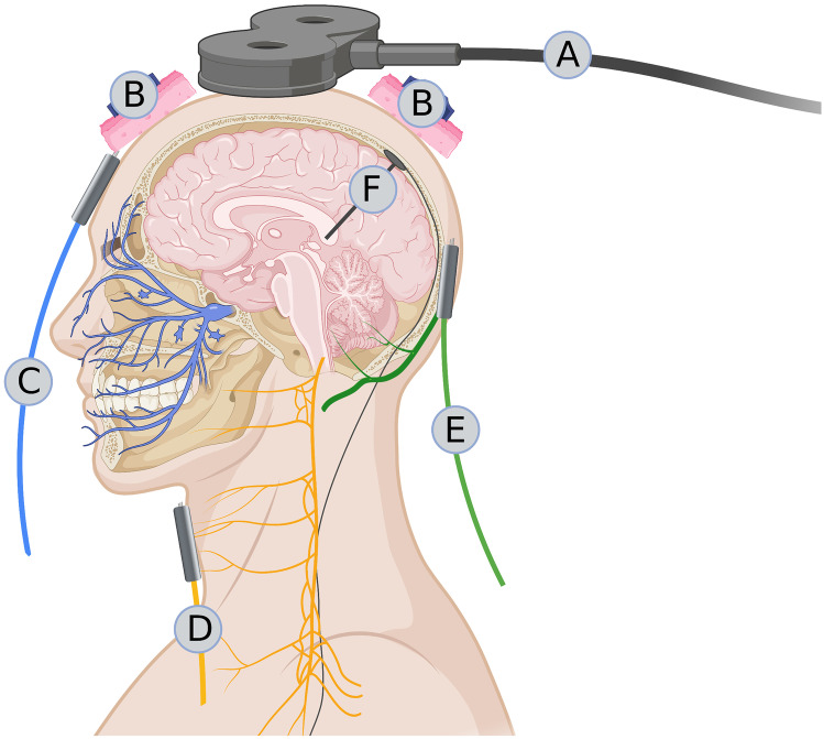 Fig. 1