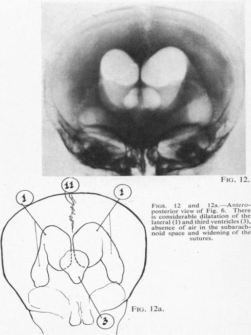 Figs. 12 and 12a