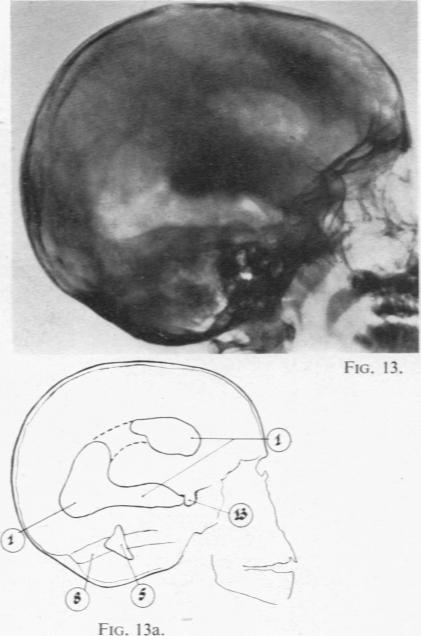 Figs. 13 and 13a