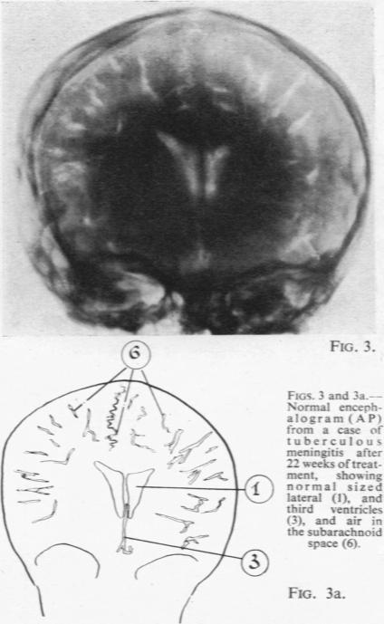 Figs. 3 and 3a