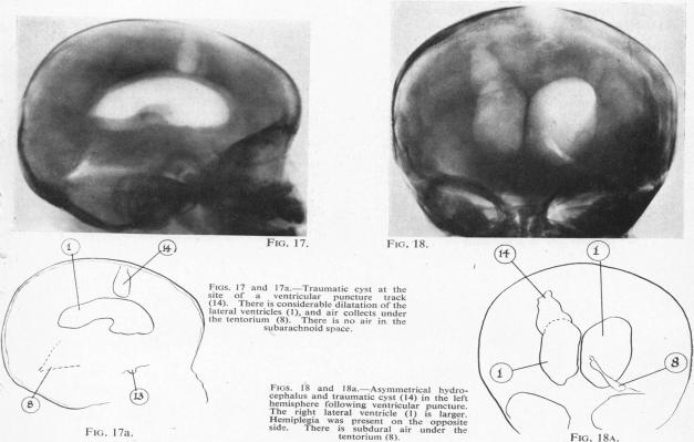 Figs. 17 and 17a, 18 and 18a