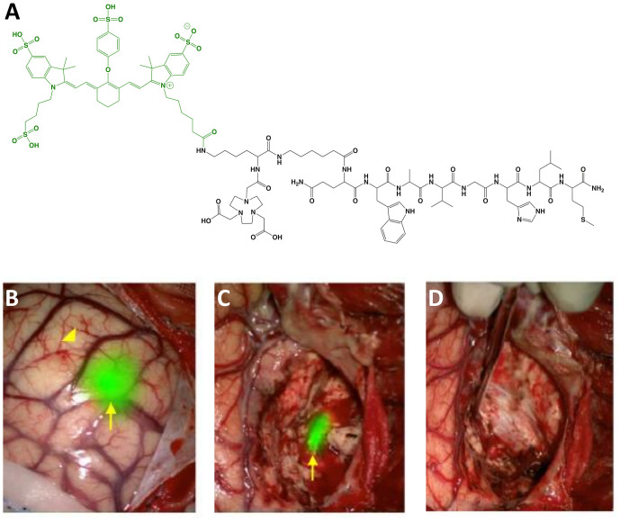 Figure 4