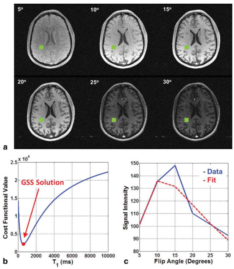 FIG. 1