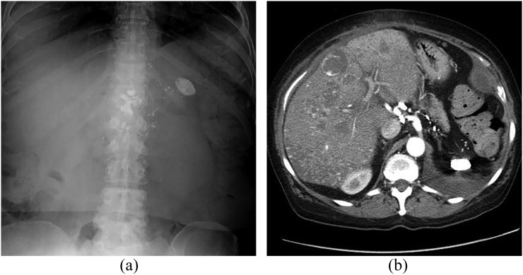 Figure 11.