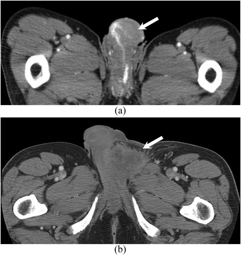 Figure 13.