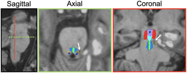 Figure 4.