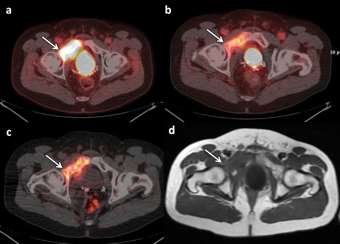 Figure 11.