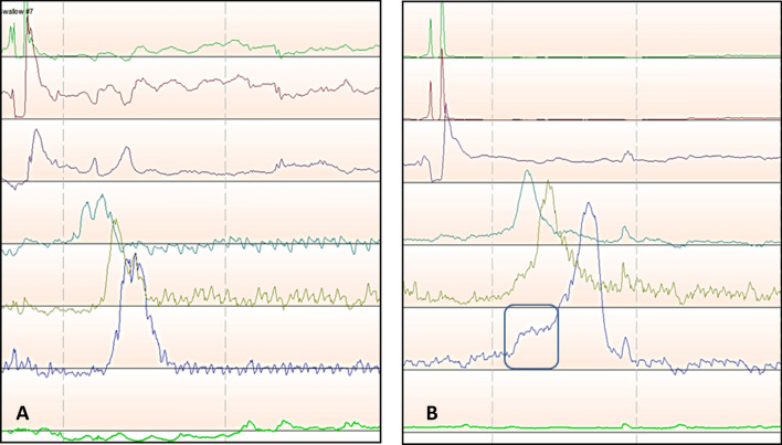 Fig. 4