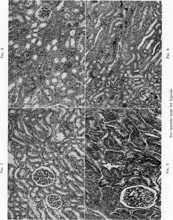 Fig. 1., Fig. 2., Fig. 3., Fig. 4.