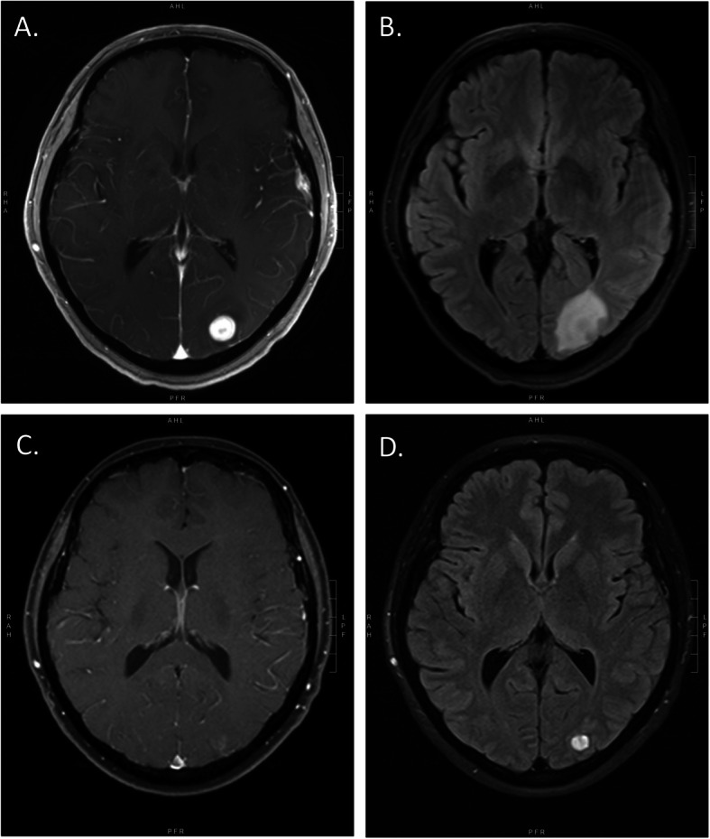 Fig. 2