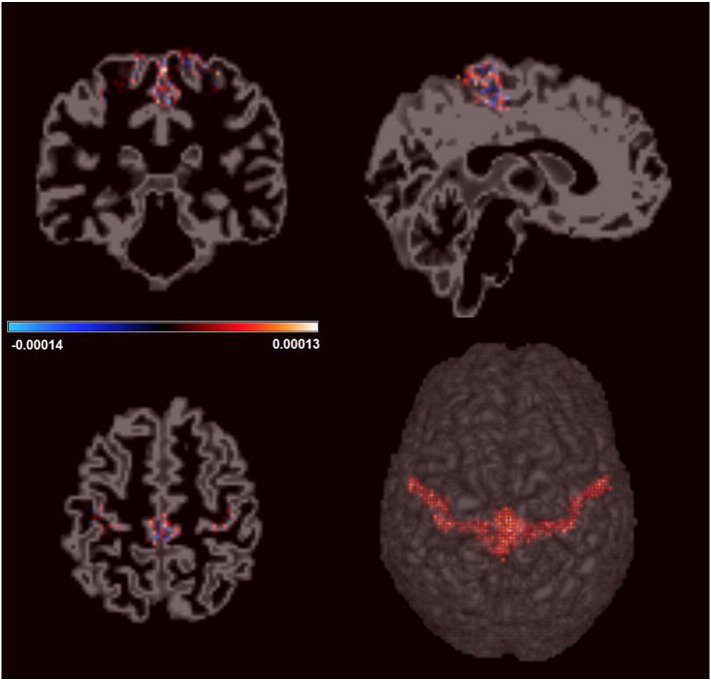 Fig. 4