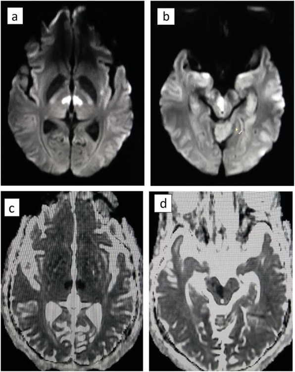 Fig. 2