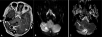 Fig. 5