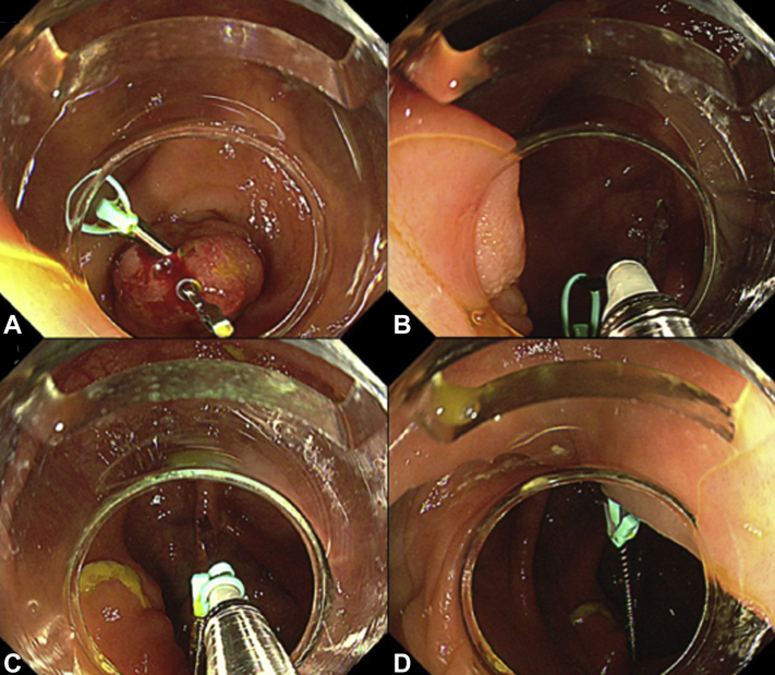 Figure 3