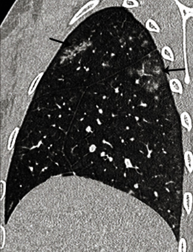 Fig. 7