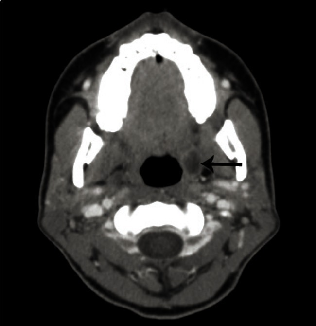 Fig. 6