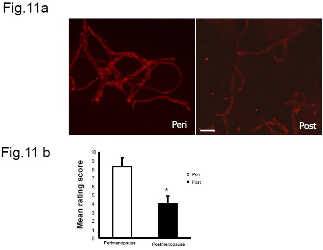 Fig.11