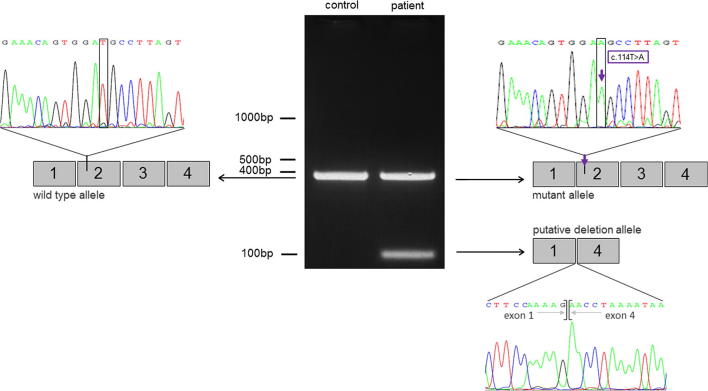 Fig. 2