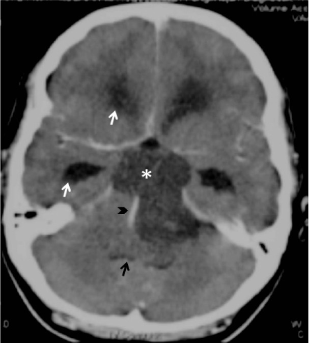 Figure 1: